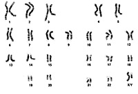 人間（男性）の染色体